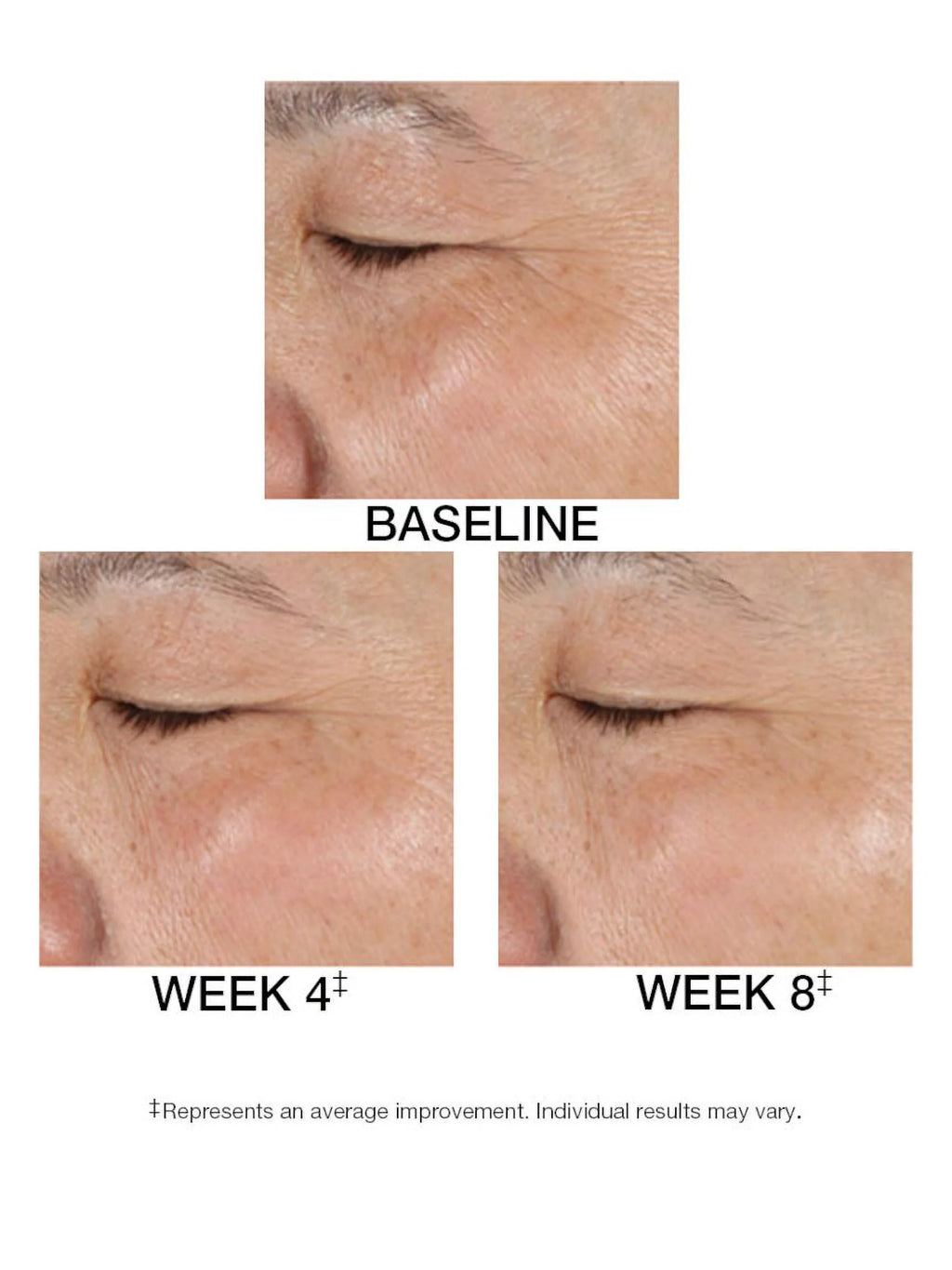 1.5 FL. OZ. Serum D34398