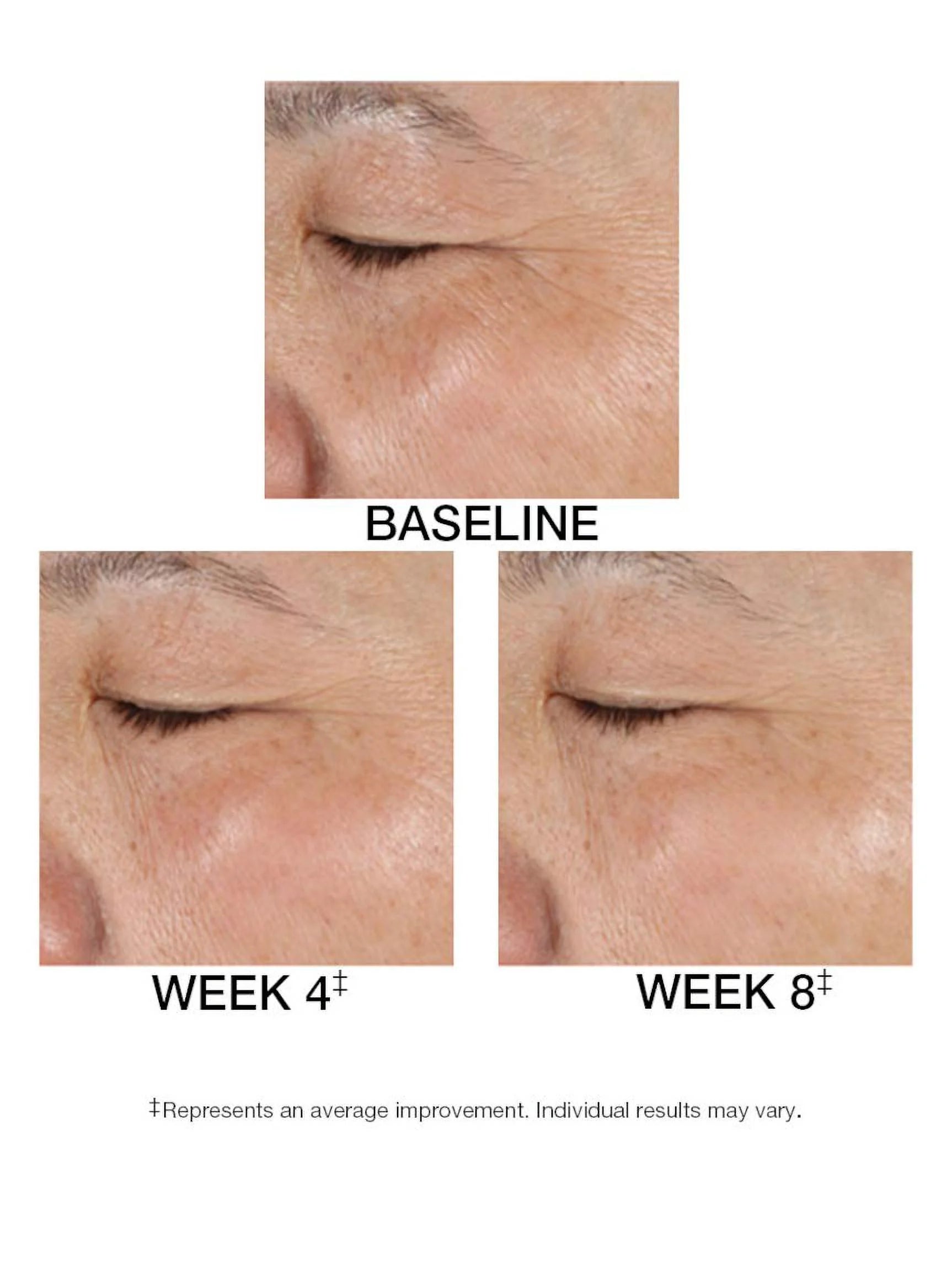 1.5 FL. OZ. Serum D34398