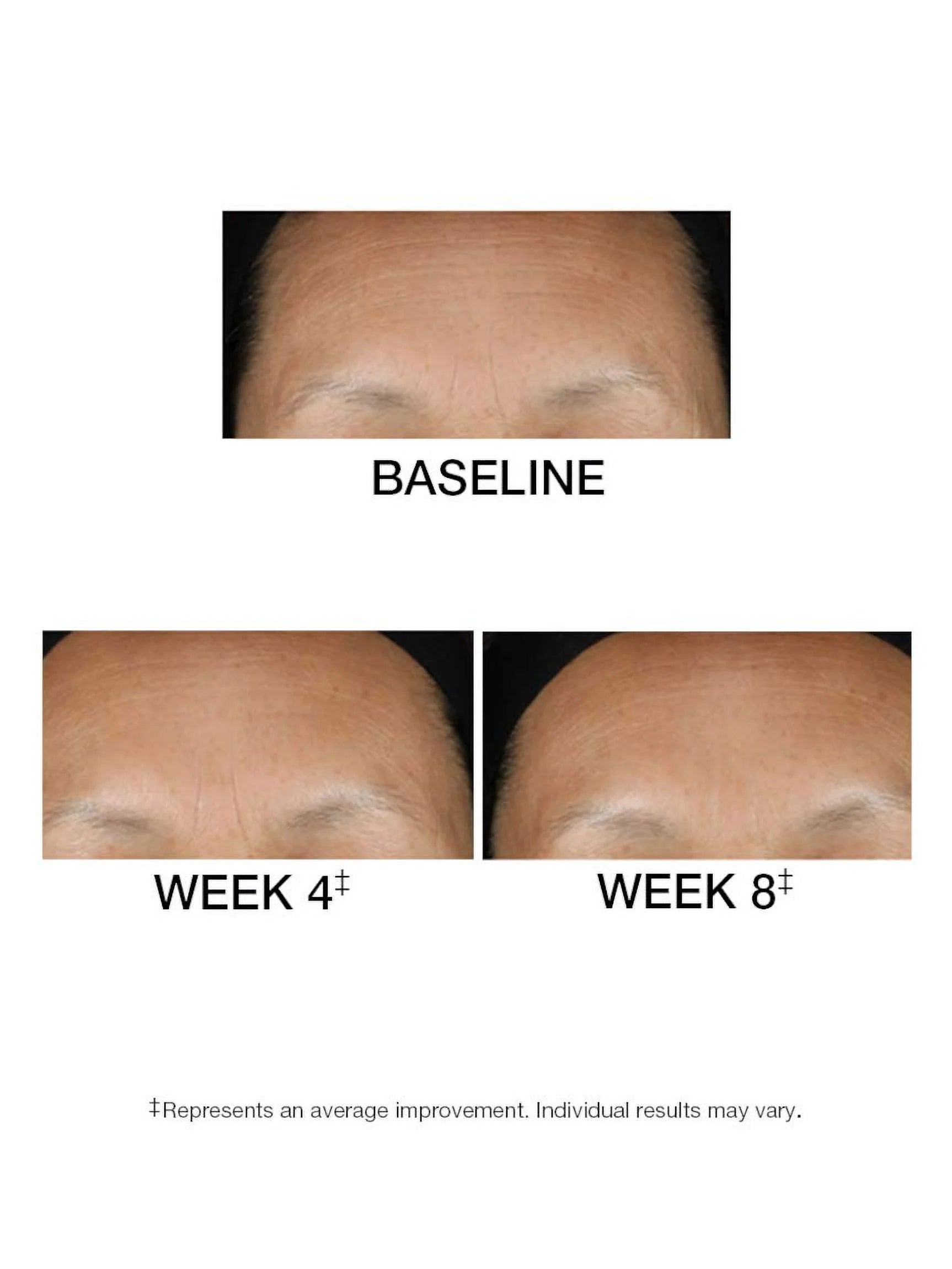 1.5 FL. OZ. Serum D34398