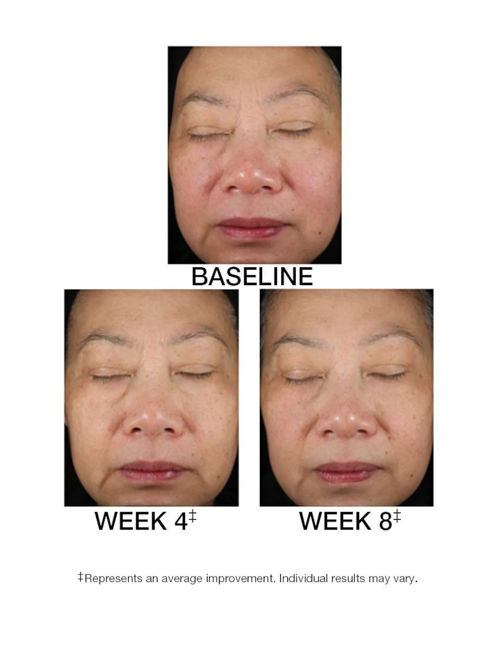 1.5 FL. OZ. Serum D34398